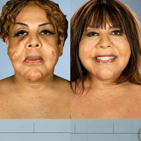 Botched E! Online Botched E! Online